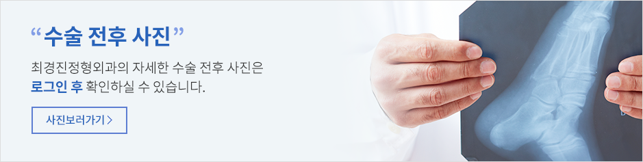 수술 전후 사진 보러가기