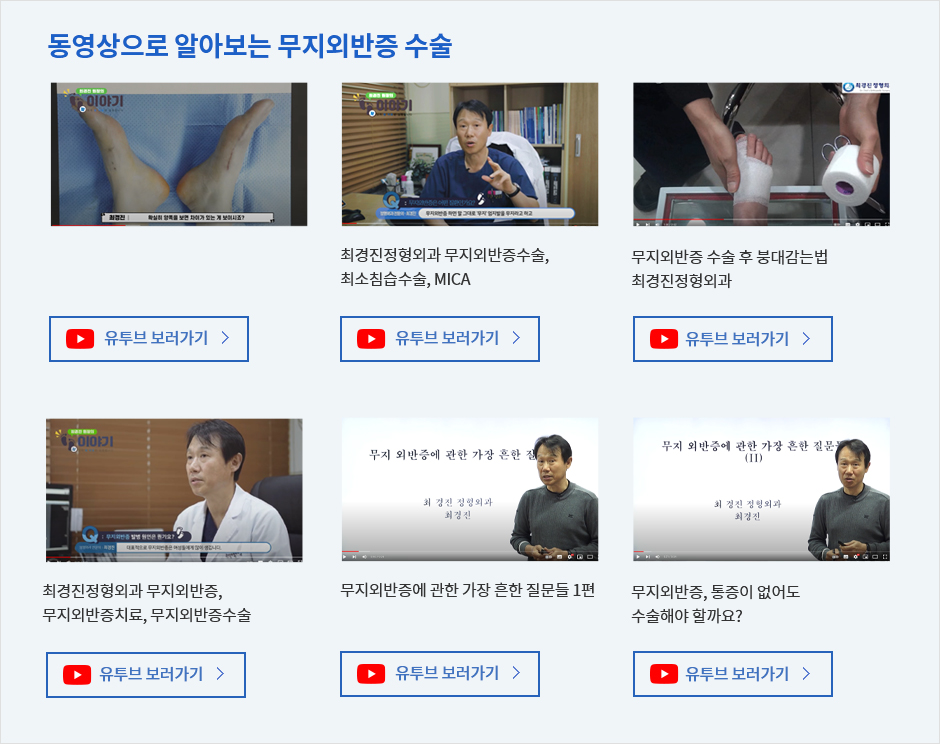동영상으로 알아보는 무지외반증 수술
